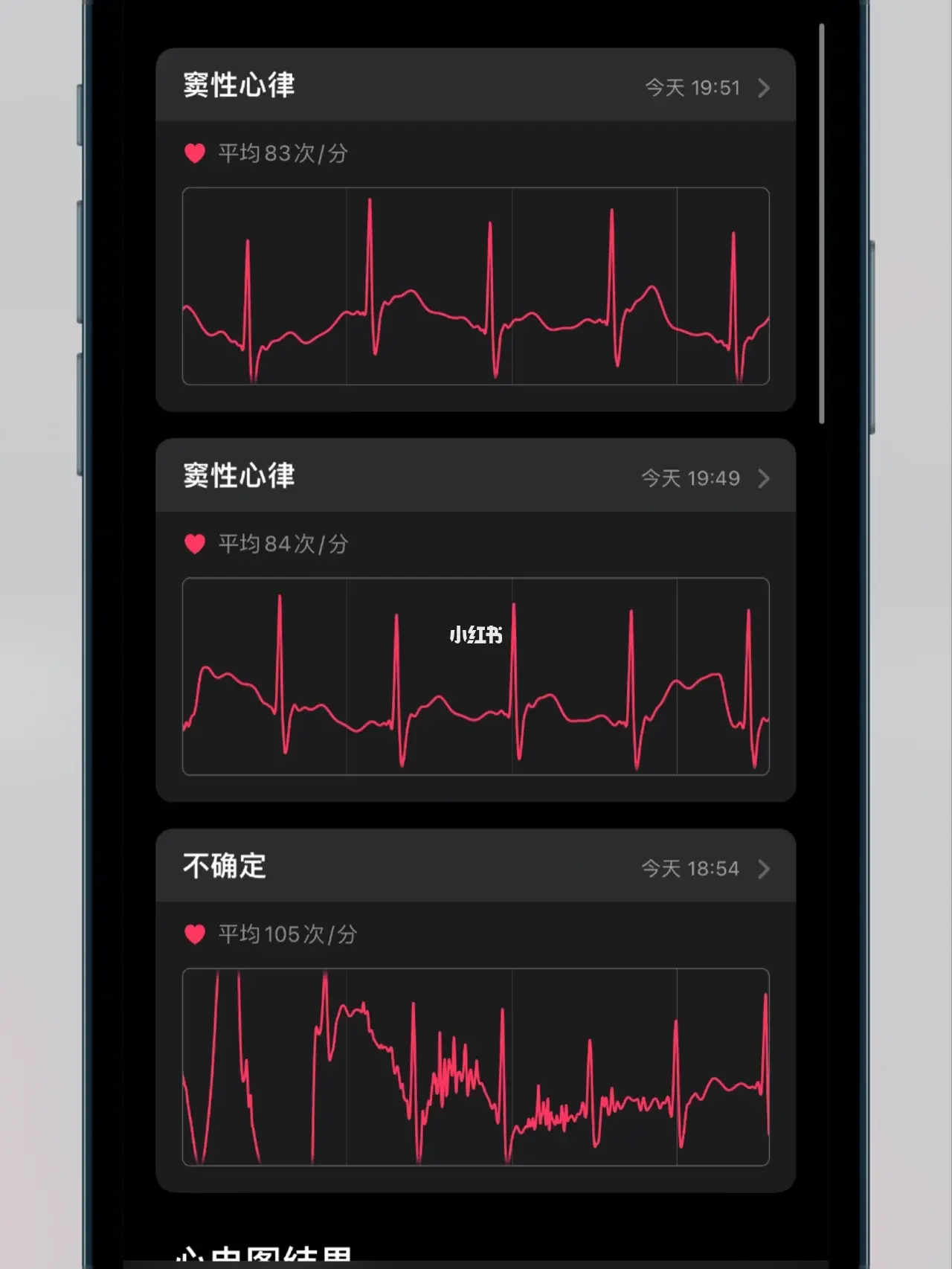 心电图iOS版安卓心电图ppt课件免费下载-第2张图片-太平洋在线下载